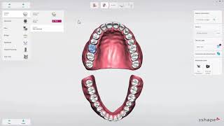 Introduction to 3Shape TRIOS on Dental Desktop [upl. by Aikel]