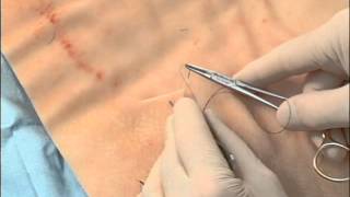 8 Common Suture Techniques for Skin Closure [upl. by Aryaz992]