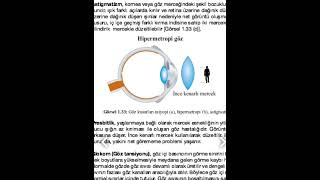 Göz kusurları  animasyon [upl. by Gurl]