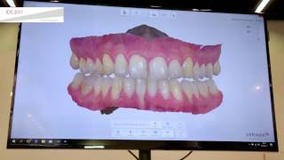 Introducing 3Shape TRIOS Patient Specific Motion [upl. by Gadmon459]