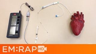 Placing a Transvenous Pacemaker [upl. by Nosnirb901]