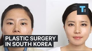 Plastic surgery in South Korea [upl. by Deer350]