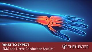 What to Expect During Nerve Conduction Studies and EMG Tests [upl. by Sudaorb424]