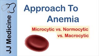 Anemia  Microcytic vs Normocytic vs Macrocytic [upl. by Arised865]