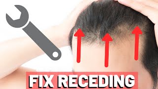 5 POWERFUL Receding Hairline TRICKS to INSTANTLY Improve Your Look [upl. by Schonthal299]