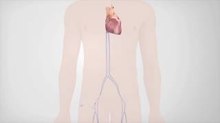 Radiofrequency Catheter Ablation [upl. by Etnelav]