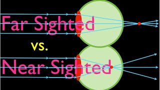 Visual acuity test Snellen chart [upl. by Sihun]