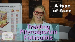 Treat Pityrosporum Folliculitis Dermatologists Tips 2019 [upl. by Atrebla]