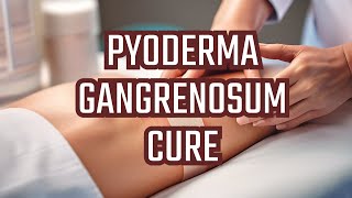 Treatment of Pyoderma gangrenosum [upl. by Eyaj299]