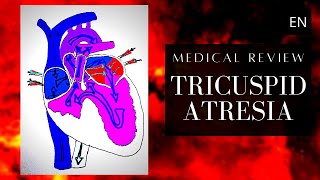 Tricuspid Atresia Anatomy Pathology and Treatment [upl. by Damiano]