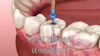 Kanal Tedavisi  Endodonti [upl. by Tyoh]