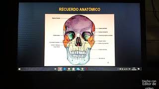 Fracturas de Cráneo  Imagenología [upl. by Tahp]