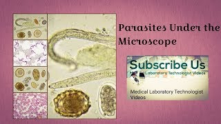 Parasites Under The Microscope [upl. by Connell]