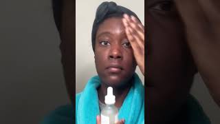 3 Reasons To Use The Ordinary Niacinamide Serum On Oily Skin [upl. by Enilreug]