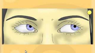 Cranial Nerve 6 palsy [upl. by Naasar401]