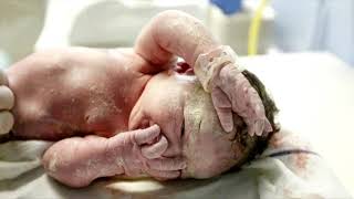 The Natural barrier that protects new born baby skin Vernix [upl. by Shien]