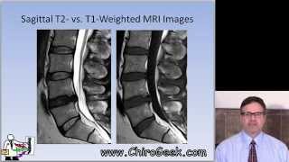 Dr Gillard lectures on How to Read Your Lumbar MRI [upl. by Enelrihs]