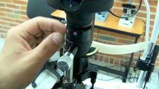 LAMPARA DE HENDIDURA  SLIT LAMP [upl. by Breena]