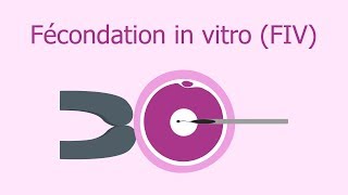 Fécondation in vitro FIV  Vidéo explicative [upl. by Tully404]