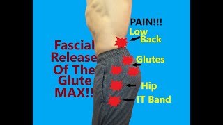 The Best Gluteus Maximus Pain Treatment Myofascial Release [upl. by Aehsal]