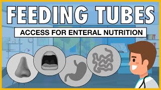 Types of Feeding Tubes EXPLAINED [upl. by Boylston565]