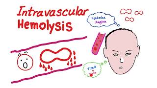 Intravascular Hemolysis [upl. by Annayk]