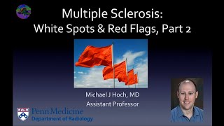 Clinical progression of multiple sclerosis  Nervous system diseases  NCLEXRN  Khan Academy [upl. by Afira865]