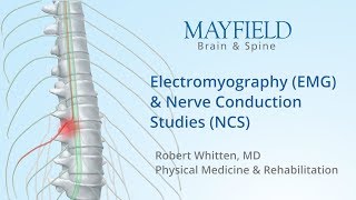 Electromyography EMG amp Nerve conduction studies NCS [upl. by Alford]