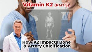 Vitamin K2 Part 5 How K2 Impacts Bone amp Artery Calcification [upl. by Shapiro]