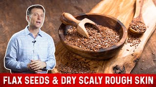 Flaxseed Benefits for Skin amp Symptoms of Linoleic Acid Deficiency – Dr Berg [upl. by Anidem]