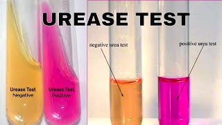 Urea Hydrolysis Urease Test [upl. by Wise]