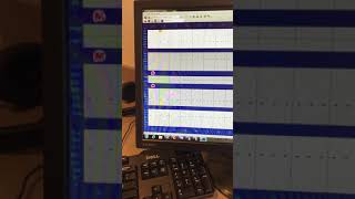 Xrays and Perio Chart for Dentrix [upl. by Nevak]