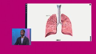 COPD vs Emphysema [upl. by Ayek]