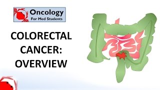 Colorectal Cancer An overview [upl. by Haym]