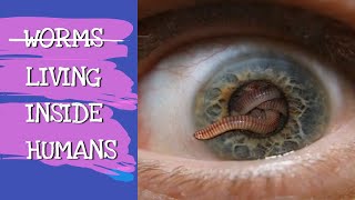 WORMS LIVING INSIDE HUMANS  EXPLAINED [upl. by Marta]