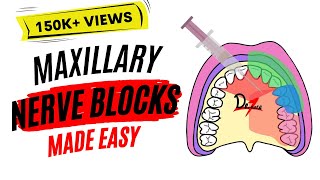 Maxillary Nerve Block Anesthesia For Dental Procedures [upl. by Floris598]