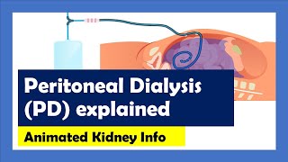 Peritoneal Dialysis explained [upl. by Evante957]