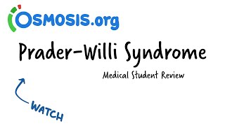 PraderWilli Syndrome  CRASH Medical Review Series [upl. by Shelly]