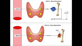 Knee Osteoarthritis Bone On Bone Knee Pain Relief Treatment By DrBerg [upl. by Lahey]