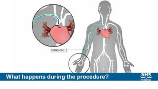 Coronary Angiography Albert Raizner MD [upl. by Ethelred]