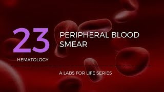 How to make Peripheral Blood Smears 3 ways [upl. by Sefton776]