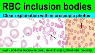 Inclusion bodies  red blood cell inclusions bodiesdetailsmicroscopic photos [upl. by Boru]