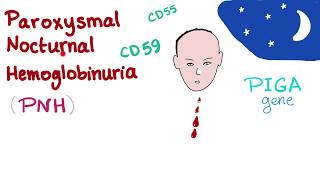 Paroxysmal Nocturnal Hemoglobinuria PNH  Hemolytic Anemia  Complement Alternative Pathway [upl. by Zingg419]