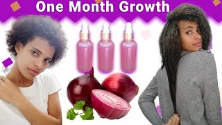 Onion Juice For Hair Growth 😱BEFORE AND AFTER RESULTS [upl. by Santana]