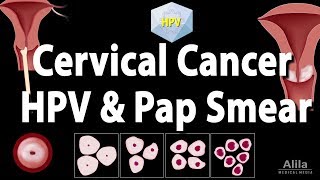 Cervical Cancer HPV and Pap Test Animation [upl. by Nabe]