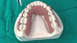 Peridontal Suturing Techniques [upl. by Lerrehs279]