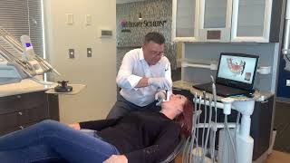 How to Use 3Shape TRIOS 4 Intraoral Scanner [upl. by Fontana]