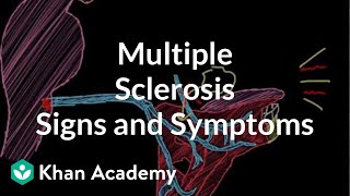 Multiple sclerosis – white spots and red flags  part 2  Mimics and Variants [upl. by Girovard170]