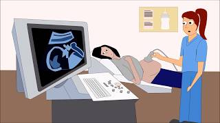 Mechanism of Labor I Dr Shonali Chandra I OBGYN I StupireMed [upl. by Opiak]