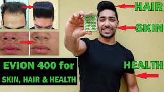 EVION 400  Uses SideeffectsBenefits for Skin Hair Bodybuilding Hindi [upl. by Enyaz200]